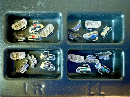 rurki-ortodontyczne-effector-roth-mbt-optimal-orthodontics