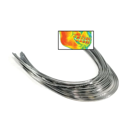 luki-ortodontyczne-thermal-niti-optimal-orthodontics