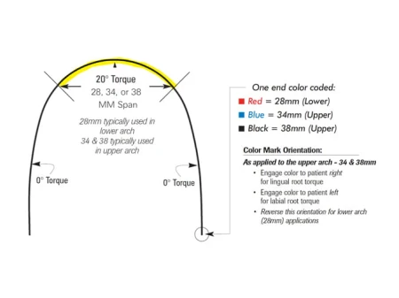 luki-ortodontyczne-niti-torkujace-optimal-orthodontics